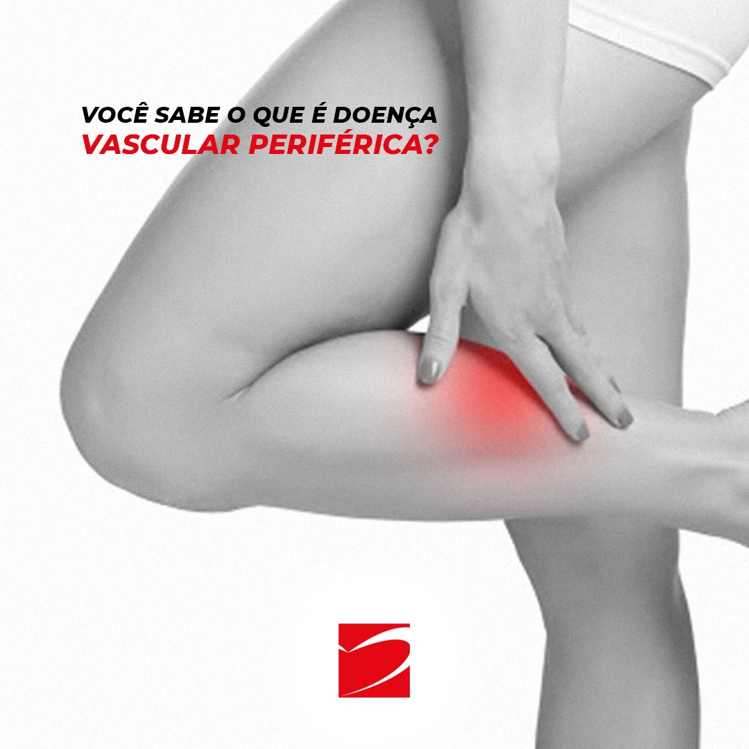 Doença vascular periférica